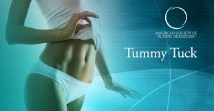 Tummy Tuck